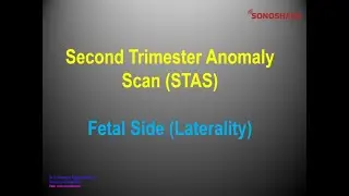 Anomaly Scan &ndash; Fetal Side (Laterality)