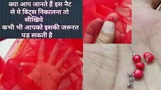 How to remove net beats  //  इस नैट से ये मजबूत तरीके से लगे हुए मोटी निकालना सीखें