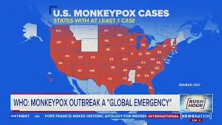 Harry Nelson, healthcare public policy expert and attorney on to discuss monkey pox | Rush Hour
