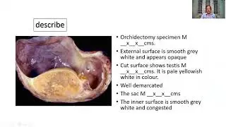 GAME 58 | Hydrocele | Testes | MBBS | Pathology | Practical exam | Specimen | SRM | Dr GSS |