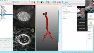 SimVascular Tutorial 4: Machine Learning 2D Segmentation