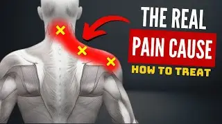 How to Treat the REAL Cause of NECK PAIN (Cervical Spine)