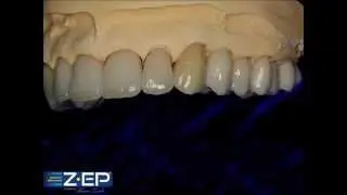 Tanaka Z&bull;EP&reg; Zirconia Solutions, Excellent Full-mouth Result