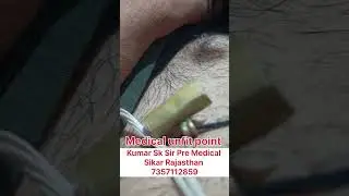 medical unfit point ll SSC GD 2025 medical ll cpo si medical #kumarsksir #ssbgd #army