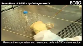 Subculture of hESCs by Collagenase