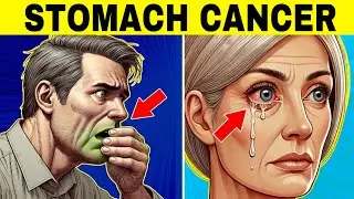 8 Strange Signs of STOMACH CANCER (Symptoms of Gastric Cancer)