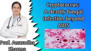 Cryptococcus: A Deadly Fungal Infection Beyond AIDS| Cryptococcosis | Cryptococcal meningitis