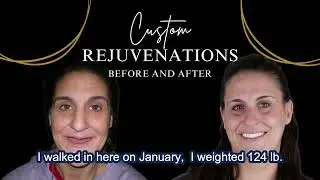 How does it feel to wear dentures?