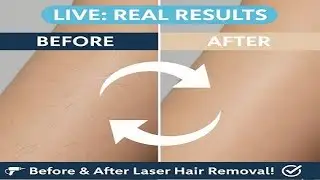 LIVE: Real Before and After Laser Hair Removal Results | How Effective Is It Really #beautycare