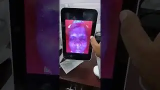 Skin analyzer machine by Laser service bd #skincare #skinanalysis 