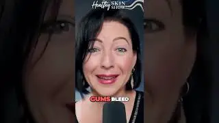Brilliant Dental Hacks REVERSE Gingivitis At Home 🎉 #shorts