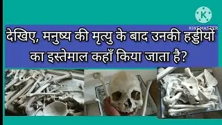Bones of human body | human skeleton system #skletonsystem #bones #anatomy