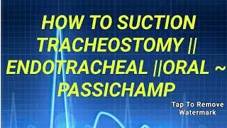 how to suction tracheostomy || endotracheal || oral ~ passichamp #medicalknowledgemedia