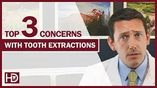 Top 3 Concerns with Tooth Extractions