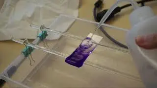 🔬 -1 How to observe bacteria with a microscope | Microscopy