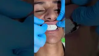 WhatsApp 03119581698 #song #hindisong #love #music #doctor #dentalartistry #teethwhiteningpowder
