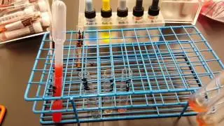 Blood Banking: ABO&D testing Part 2 Result Interpretation