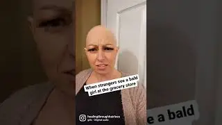 Happens all the time #alopecia #alopeciaawareness #alopeciauniversalis #alopeciaareata #baldlife
