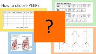 Hypoxemic Respiratory Failure Wong