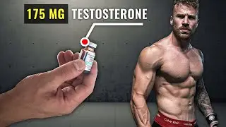 1 Year on Testosterone (SIDE EFFECTS? GAINS? REGRETS?)