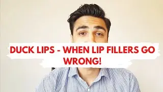 How to Avoid Duck Lips - When Lip Fillers Go Wrong | Rejuveo Aesthetics