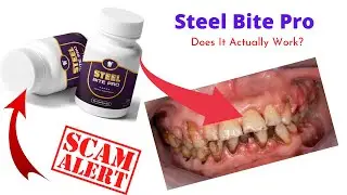 Steel Bite Pro Review[2021] Legit Or A Scam? Steel Bite Pro Supplement...