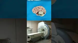 This AI Can Read Minds