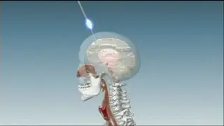 euronews science - Maladie de Parkinson : bient&ocirc;t un rem&egrave;de?