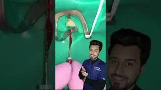 This is the tooth pulp we remove during Rct #hindi #dentist #urdu #views #dentistry #rct #pakistan
