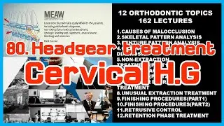 80.Headgear (1) treatment : Cervical H.G
