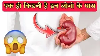 Kidney velley || kidney village || Nepal  | Mysterious fact #shorts