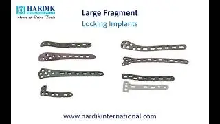 Large Fragment Locking Implants