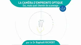 La caméra d'empreinte optique, oui, mais quel chemin de scannage ?