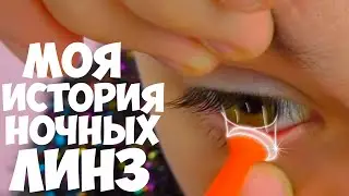 Что случилось с Глазами?  История о моём ПЛОХОМ Зрении😱