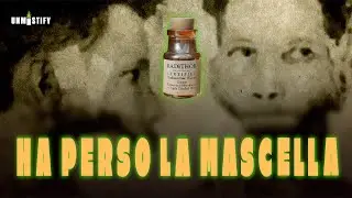 PRODOTTI RADIOATTIVI degli Anni '20: Il Caso EBEN BYERS