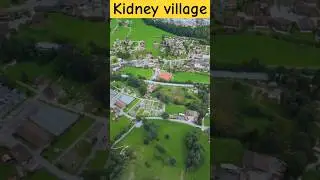 kidney village | nepal kidney village | #viral #ytshort #facttechz #ytshortsvideo #trending #shorts