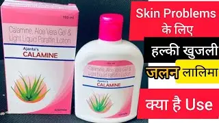 Ajanta's CALAMINE LOTION Calamine, Aloe Vera Gel & Light Liquid Paraffin Lotion