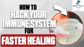 How To Hack Your Immune System for Faster Healing - Smile Sisters Podcast