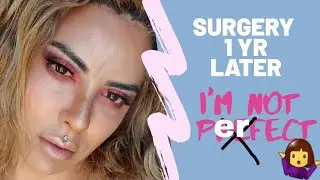 1 YR Jaw Surgery// FFS// Facial Feminization Surgery
