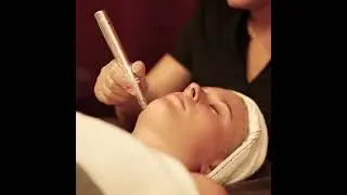 Micro Needling Christchurch, V For Hair and Beauty Merivale.