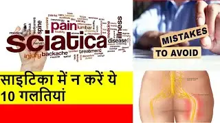 Sciatica pain best tips and natural treatment|Do not make these 10 mistakes in sciatica.