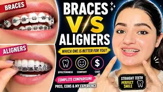Metal Braces OR Aligners | Which One Is Best for YOU?