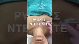 &Rho;&upsilon;&tau;ί&delta;&epsilon;&sigmaf; &Sigma;&tau;&omicron; &Nu;&tau;&epsilon;&kappa;&omicron;&lambda;&tau;έ &Alpha;&nu;&tau;&iota;&mu;&epsilon;&tau;ώ&pi;&iota;&sigma;&eta; #PLLA
