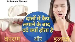 दांतों में कैप लगाने के बाद दर्द क्यों होता है,जानिए कारण/इलाज,pain after tooth capping and bridge