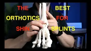 The Best Insoles For Shin Splints