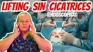 Rejuvenecimiento Facial sin cicatrices visibles I Lifting Endoscópico