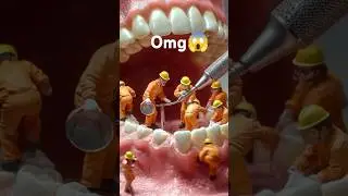 omg😱 Mini Workers Fixing Teeth &ndash; Mind-Blowing Dental Art!