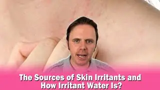 The Sources of Skin Irritants and How Irritant Water Is?