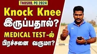 TNUSRB/SI 2024 Knock Knee இருப்பதினால் Medical Test-ல் பிரச்சனை வருமா🤔என்ன செய்யலாம்❓#si2024 #tnusrb