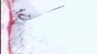 Herman Maier Nagano Crash